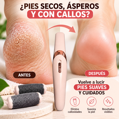 Removedor de Callos